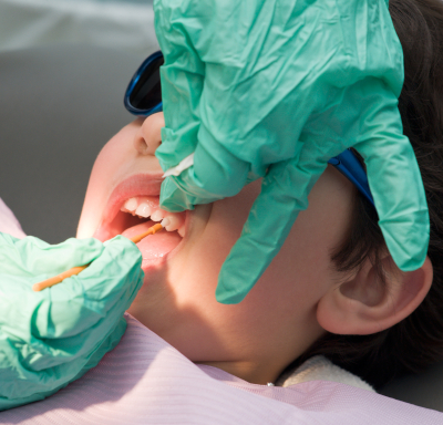 fluoride pediatric dentistry